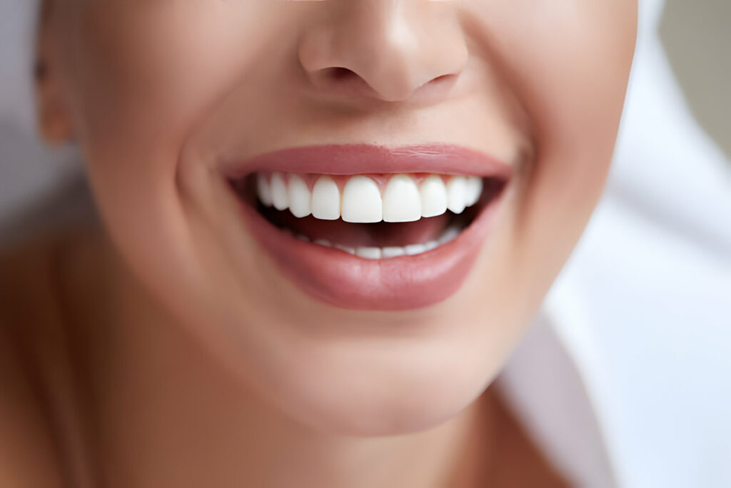 Why Should You Consider Teeth Whitening In Killeen, TX_1