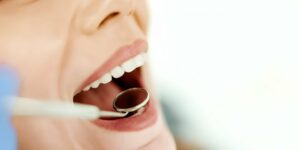 Tooth Extraction Aftercare - As Explained by A Preventive Dentist