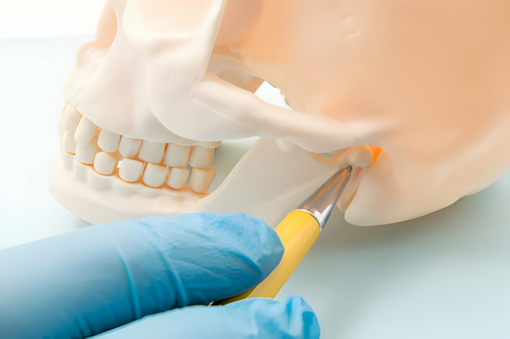 Understanding TMJ Dysfunction: Cause, Symptoms, and Treatments_2