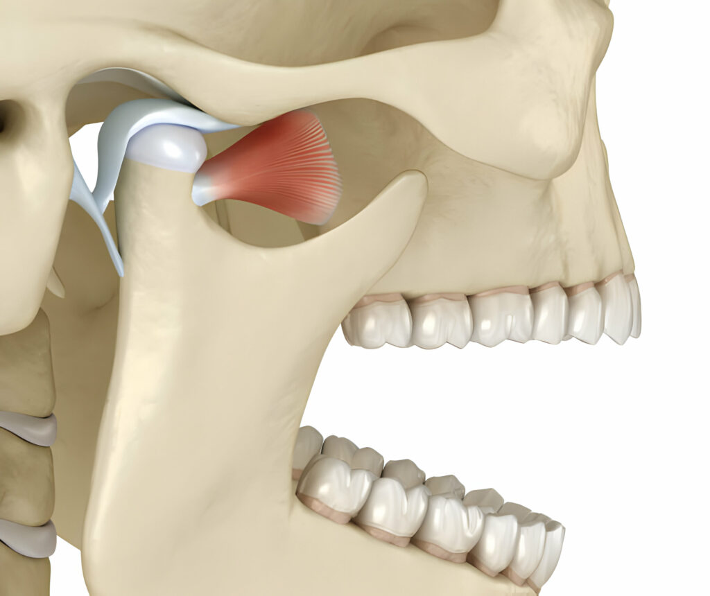 Understanding TMJ Dysfunction: Cause, Symptoms, and Treatments_3