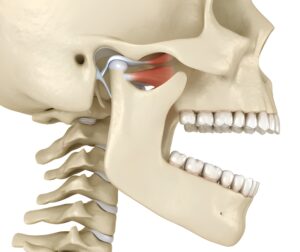 TMD vs. TMJ: What’s the Difference? Killeen, TX Dentist Explains Clearly_FI