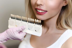 Are Porcelain Veneers Right for You? Killeen Dentist Explains the Signs_FI
